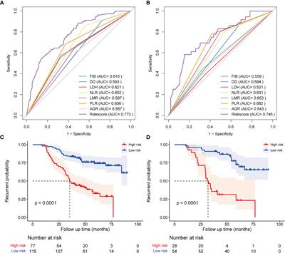 A Clinical Prognostic Model Based on Preoperative Hematological and Clinical Parameters Predicts the Progression of Primary WHO Grade II Meningioma